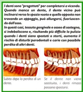 lom perdita denti