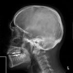 radiografia base lom turismo dentale