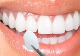 faccette dentali lom srl